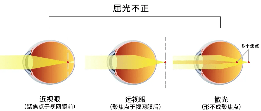 1ab9fc70070a4122aee52e8183ef5bea.png