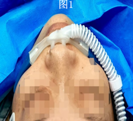 ad745155648e4bc39fd6a481ccf86271.png